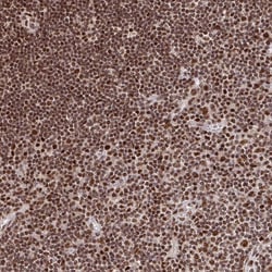 Invitrogen ZDHHC12 Polyclonal Antibody 100 &mu;L; Unconjugated:Antibodies,