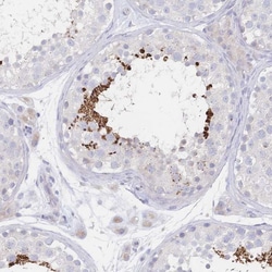 Invitrogen VWC2L Polyclonal Antibody 100 &mu;L; Unconjugated:Antibodies,