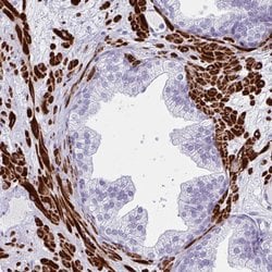 Invitrogen GRXCR2 Polyclonal Antibody 100 &mu;L; Unconjugated:Antibodies,