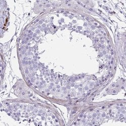 Invitrogen GRXCR2 Polyclonal Antibody 100 &mu;L; Unconjugated:Antibodies,