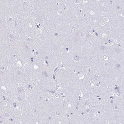 Invitrogen GRXCR2 Polyclonal Antibody 100 &mu;L; Unconjugated:Antibodies,