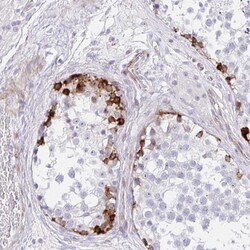 Invitrogen ZNF713 Polyclonal Antibody 100 &mu;L; Unconjugated:Antibodies,