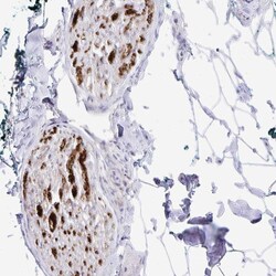 Invitrogen CRG-L2 Polyclonal Antibody 100 &mu;L; Unconjugated:Antibodies,