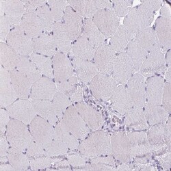Invitrogen OR4B1 Polyclonal Antibody 100 &mu;L; Unconjugated:Antibodies,