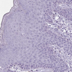 Invitrogen OR4B1 Polyclonal Antibody 100 &mu;L; Unconjugated:Antibodies,