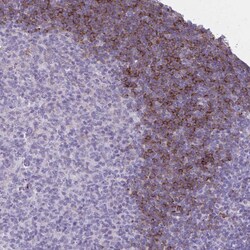 Invitrogen OR4B1 Polyclonal Antibody 100 &mu;L; Unconjugated:Antibodies,