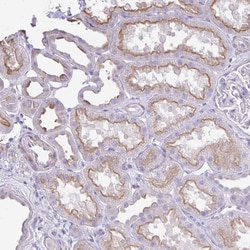 Invitrogen OR4P4 Polyclonal Antibody 100 &mu;L; Unconjugated:Antibodies,