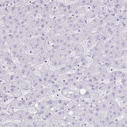 Invitrogen OR4P4 Polyclonal Antibody 100 &mu;L; Unconjugated:Antibodies,