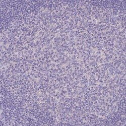 Invitrogen OR4P4 Polyclonal Antibody 100 &mu;L; Unconjugated:Antibodies,