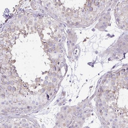 Invitrogen OR4P4 Polyclonal Antibody 100 &mu;L; Unconjugated:Antibodies,