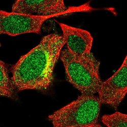 Invitrogen UGT3A2 Polyclonal Antibody 100 &mu;L; Unconjugated:Antibodies,