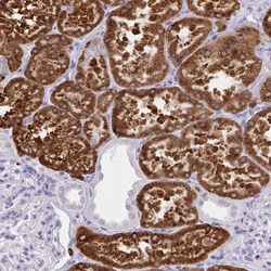 Invitrogen UGT3A2 Polyclonal Antibody 100 &mu;L; Unconjugated:Antibodies,