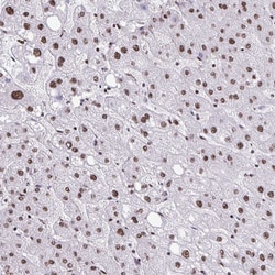 Invitrogen NRBF2 Polyclonal Antibody 100 &mu;L; Unconjugated:Antibodies,