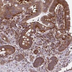 Invitrogen ALDH16A1 Polyclonal Antibody 100 &mu;L; Unconjugated:Antibodies,