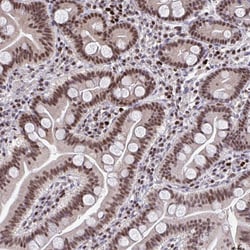 Invitrogen JDP2 Polyclonal Antibody 100 &mu;L; Unconjugated:Antibodies,