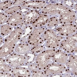 Invitrogen JDP2 Polyclonal Antibody 100 &mu;L; Unconjugated:Antibodies,