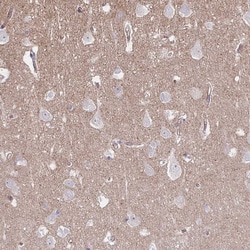 Invitrogen MUS81 Polyclonal Antibody 100 &mu;L; Unconjugated:Antibodies,