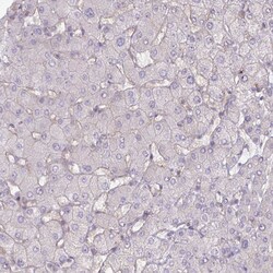 Invitrogen MUS81 Polyclonal Antibody 100 &mu;L; Unconjugated:Antibodies,