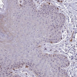 Invitrogen MUS81 Polyclonal Antibody 100 &mu;L; Unconjugated:Antibodies,