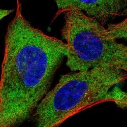 Invitrogen TMEM189 Polyclonal Antibody 100 &mu;L | Buy Online | Invitrogen&trade; | Fisher Scientific