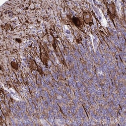 Invitrogen TMEM189 Polyclonal Antibody 100 &mu;L | Buy Online | Invitrogen&trade; | Fisher Scientific