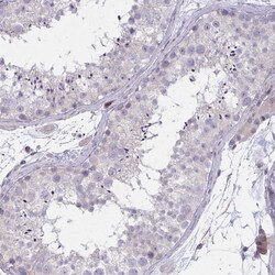 Invitrogen SLC14A1 Polyclonal Antibody 100 &mu;L; Unconjugated:Antibodies,