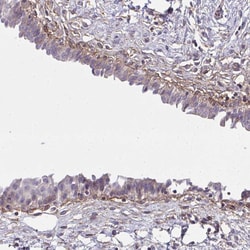 Invitrogen SLC14A1 Polyclonal Antibody 100 &mu;L; Unconjugated:Antibodies,