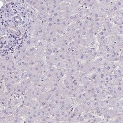 Invitrogen TTC7B Polyclonal Antibody 100 &mu;L; Unconjugated:Antibodies,
