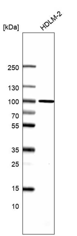 Invitrogen TTC7B Polyclonal Antibody 100 &mu;L | Buy Online | Invitrogen&trade; | Fisher Scientific