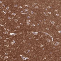 Invitrogen TTC7B Polyclonal Antibody 100 &mu;L; Unconjugated:Antibodies,