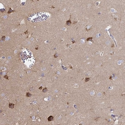 Invitrogen SLC9A6 Polyclonal Antibody 100 &mu;L | Buy Online | Invitrogen&trade; | Fisher Scientific