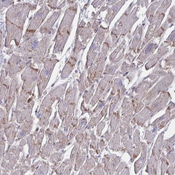 Invitrogen SLC9A6 Polyclonal Antibody 100 &mu;L | Buy Online | Invitrogen&trade; | Fisher Scientific
