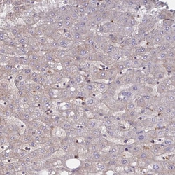 Invitrogen SLC9A6 Polyclonal Antibody 100 &mu;L | Buy Online | Invitrogen&trade; | Fisher Scientific