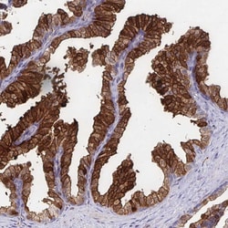 Invitrogen CDKL1 Polyclonal Antibody 100 &mu;L | Buy Online | Invitrogen&trade; | Fisher Scientific