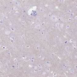 Invitrogen RHBDL3 Polyclonal Antibody 100 &mu;L; Unconjugated:Antibodies,