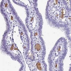 Invitrogen RHBDL3 Polyclonal Antibody 100 &mu;L; Unconjugated:Antibodies,