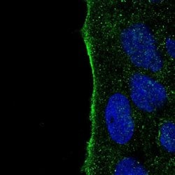 Invitrogen IYD Polyclonal Antibody 100 &mu;L; Unconjugated:Antibodies,