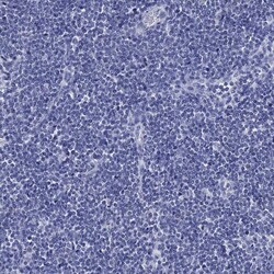 Invitrogen IYD Polyclonal Antibody 100 &mu;L; Unconjugated:Antibodies,