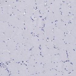 Invitrogen IYD Polyclonal Antibody 100 &mu;L; Unconjugated:Antibodies,