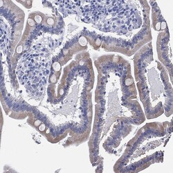 Invitrogen IYD Polyclonal Antibody 100 &mu;L; Unconjugated:Antibodies,