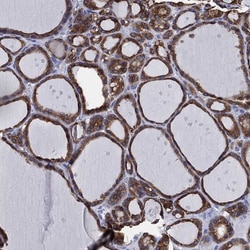 Invitrogen IYD Polyclonal Antibody 100 &mu;L; Unconjugated:Antibodies,