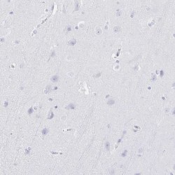 Invitrogen IYD Polyclonal Antibody 100 &mu;L; Unconjugated:Antibodies,