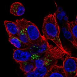Invitrogen ZDHHC7 Polyclonal Antibody 100 &mu;L; Unconjugated:Antibodies,