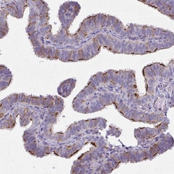 Invitrogen ZDHHC7 Polyclonal Antibody 100 &mu;L; Unconjugated:Antibodies,