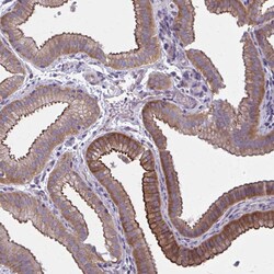 Invitrogen ZDHHC7 Polyclonal Antibody 100 &mu;L; Unconjugated:Antibodies,