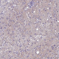 Invitrogen ZDHHC7 Polyclonal Antibody 100 &mu;L; Unconjugated:Antibodies,