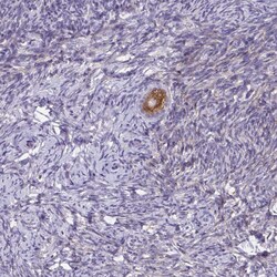 Invitrogen ZDHHC7 Polyclonal Antibody 100 &mu;L; Unconjugated:Antibodies,