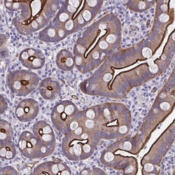 Invitrogen ZDHHC7 Polyclonal Antibody 100 &mu;L; Unconjugated:Antibodies,