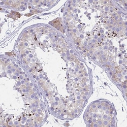 Invitrogen ZDHHC7 Polyclonal Antibody 100 &mu;L; Unconjugated:Antibodies,