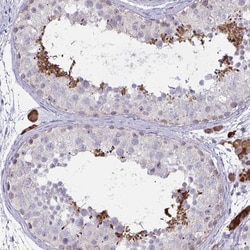Invitrogen ZNF784 Polyclonal Antibody 100 &mu;L; Unconjugated:Antibodies,